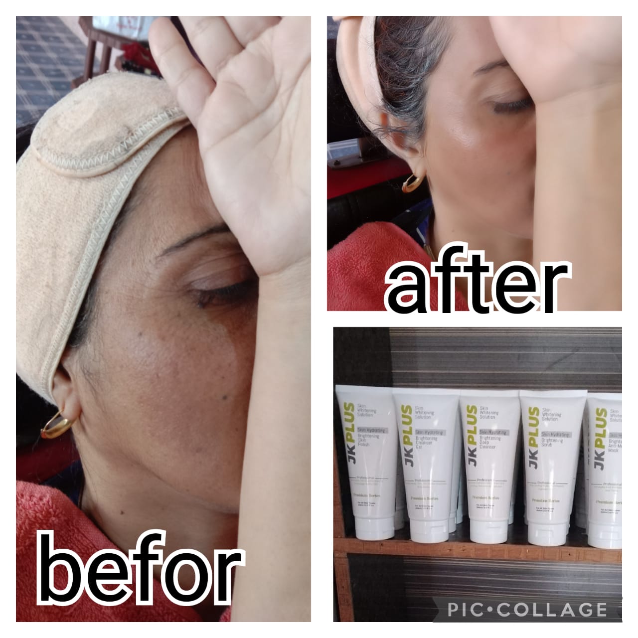 𝙅𝙆 𝙋𝙡𝙪𝙨 𝙒𝙝𝙞𝙩𝙚𝙣𝙞𝙣𝙜 𝙁𝙖𝙘𝙞𝙖𝙡 𝙎𝙚𝙩